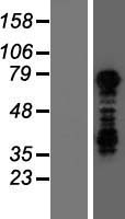 TBX3 Human Over-expression Lysate