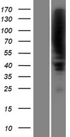 Plzf (ZBTB16) Human Over-expression Lysate