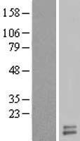 UQCRH Human Over-expression Lysate