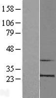 RPL10 Human Over-expression Lysate