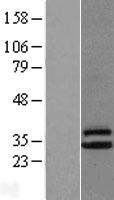 CLPP Human Over-expression Lysate