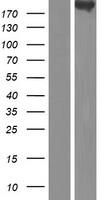 CDC42 Binding Protein Kinase Beta (CDC42BPB) Human Over-expression Lysate