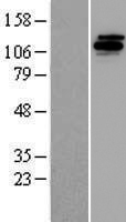 UBE4B Human Over-expression Lysate