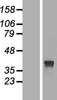 RRAGB Human Over-expression Lysate