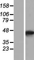 SMYD5 Human Over-expression Lysate
