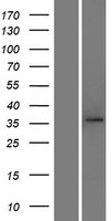 TOMM40 Human Over-expression Lysate