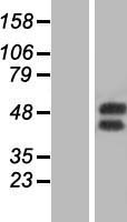 GM CSF Receptor alpha (CSF2RA) Human Over-expression Lysate