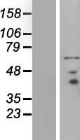 PRICKLE3 Human Over-expression Lysate