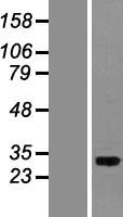 PITPN (PITPNA) Human Over-expression Lysate