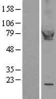 cGKI (PRKG1) Human Over-expression Lysate