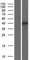 SRSF6 Human Over-expression Lysate