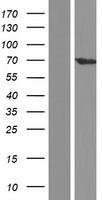 TESK1 Human Over-expression Lysate
