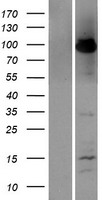 TNFAIP3 Human Over-expression Lysate
