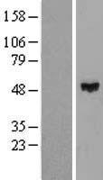 ZNF193 (ZSCAN9) Human Over-expression Lysate