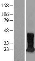 CDIPT Human Over-expression Lysate
