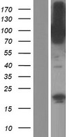 CNKSR1 Human Over-expression Lysate