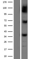 NPEPPS Human Over-expression Lysate