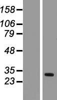 TIMM17A Human Over-expression Lysate