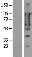 TACC3 Human Over-expression Lysate