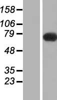 SLC9A6 Human Over-expression Lysate