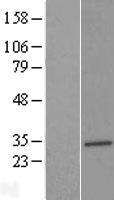 SLC25A17 Human Over-expression Lysate