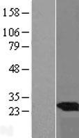 UBE2E3 Human Over-expression Lysate