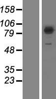 SEC23B Human Over-expression Lysate