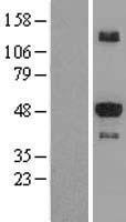 STK25 Human Over-expression Lysate