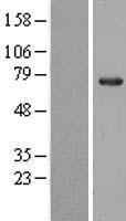 NOL5A (NOP56) Human Over-expression Lysate