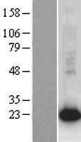 AGR2 Human Over-expression Lysate