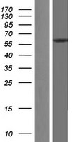 TCP1 eta (CCT7) Human Over-expression Lysate