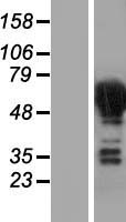 CRMP3 (DPYSL4) Human Over-expression Lysate