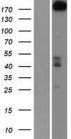 PARP4 Human Over-expression Lysate