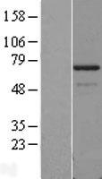 PDLIM5 Human Over-expression Lysate