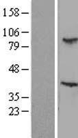 TBL3 Human Over-expression Lysate