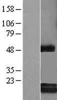 RCL (DNPH1) Human Over-expression Lysate