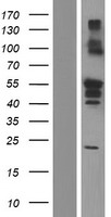 RBCK1 Human Over-expression Lysate