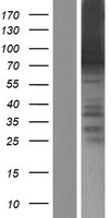 ARID3B Human Over-expression Lysate