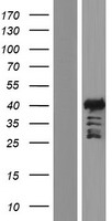 ALX3 Human Over-expression Lysate