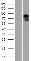SLC16A2 Human Over-expression Lysate