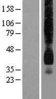 Glucose Transporter GLUT1 (SLC2A1) Human Over-expression Lysate