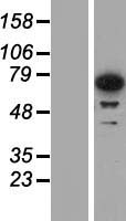 IMP3 (IGF2BP3) Human Over-expression Lysate