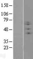 B3GNT1 (B3GNT2) Human Over-expression Lysate