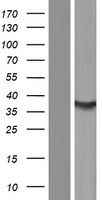 SULT1C4 Human Over-expression Lysate