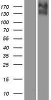 KCC4 (SLC12A7) Human Over-expression Lysate