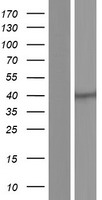 CysLT1 (CYSLTR1) Human Over-expression Lysate