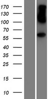 AHCYL1 Human Over-expression Lysate
