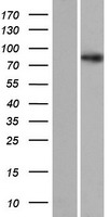 SDCCAG8 Human Over-expression Lysate