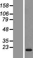 CPLX2 Human Over-expression Lysate