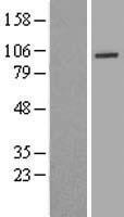 UTP14A Human Over-expression Lysate